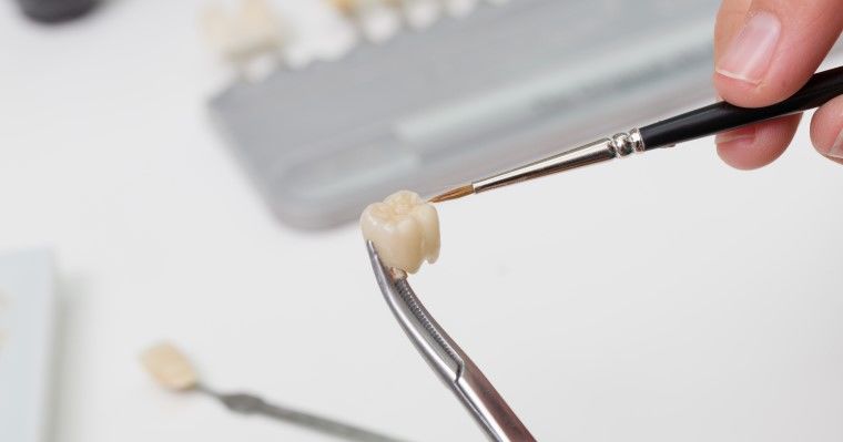 dental crown cleaning with a brush