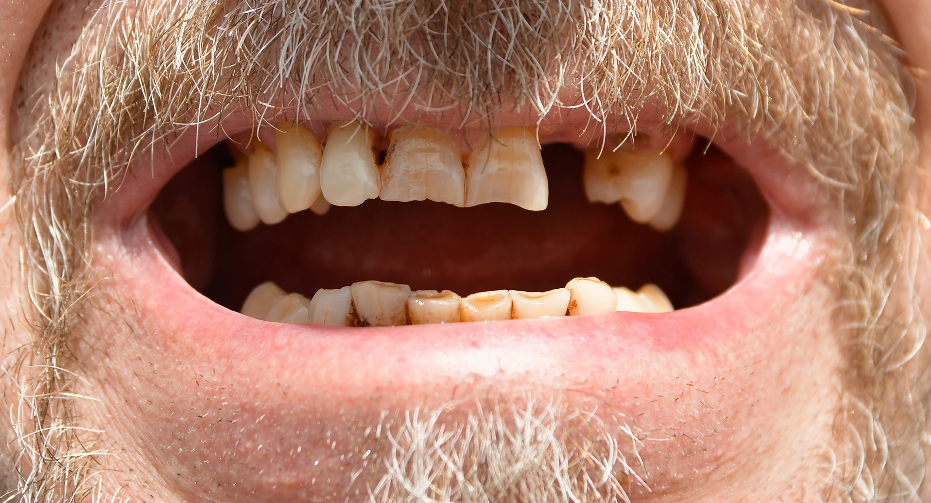 What teeth problems can tell about your overall health