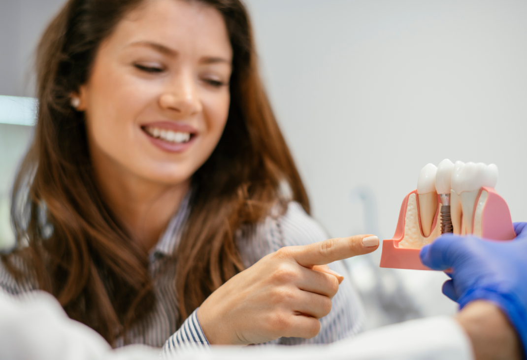 How Long Does a Dental Implant Take?