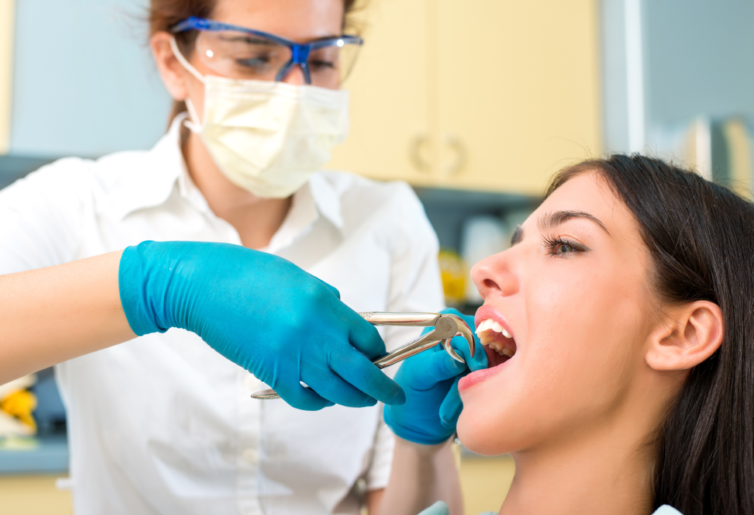 How to Prepare for Wisdom Teeth Removal